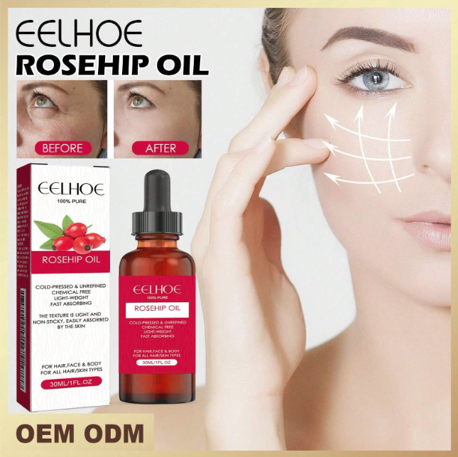 Pure Rosehip Oil